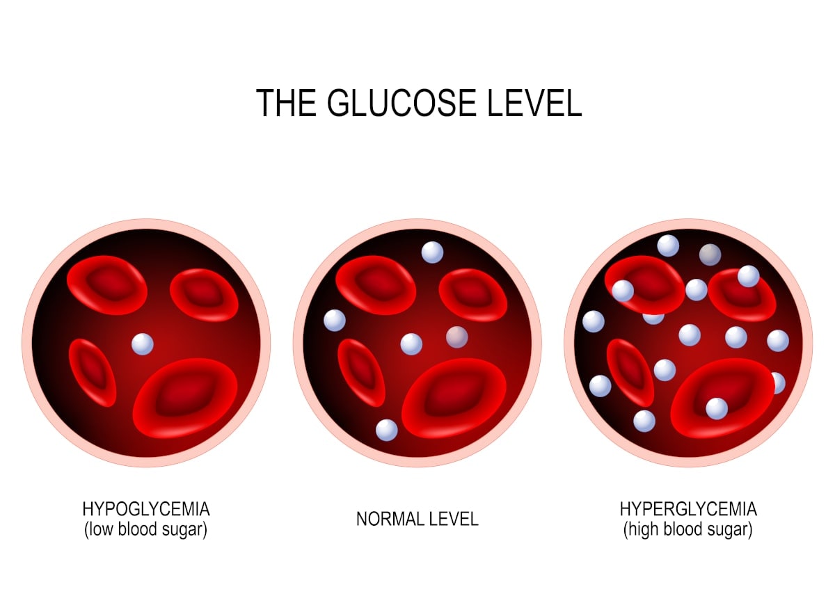 Glicemia alta quali sono i sintomi dell'iperglicemia?