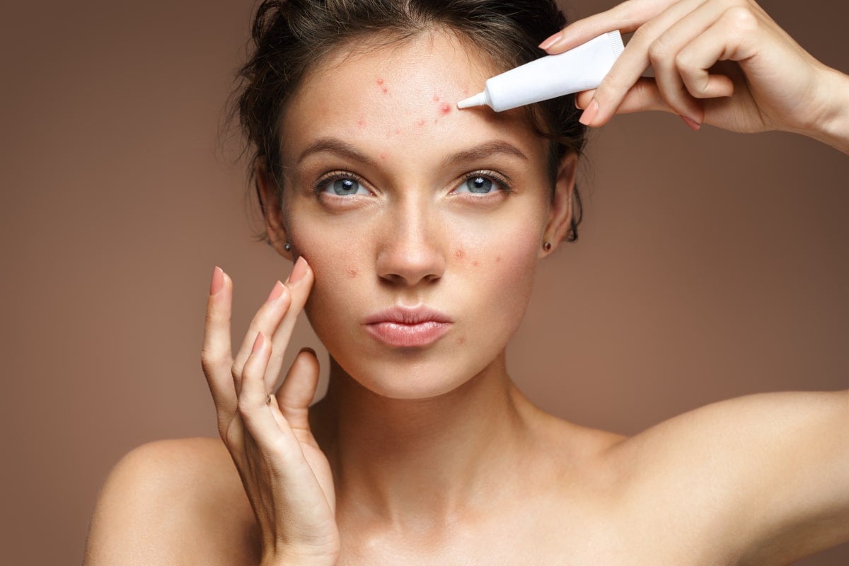 Come curare l'acne in estate