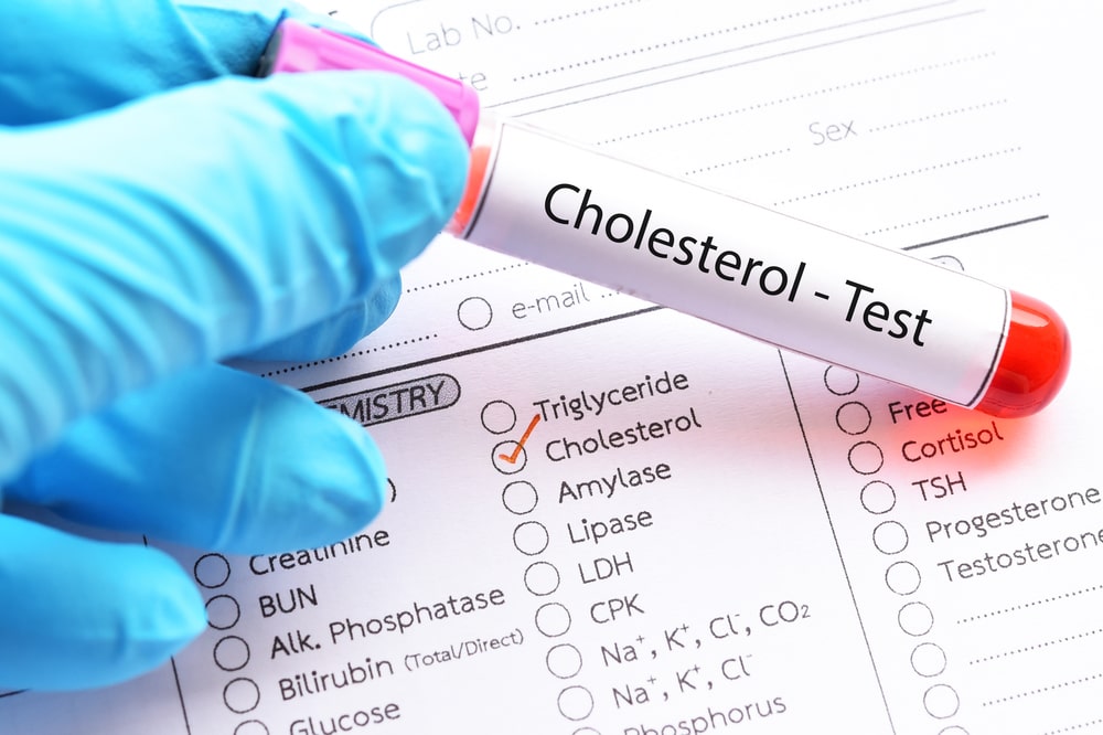 Qual è la differenza tra colesterolo e trigliceridi?