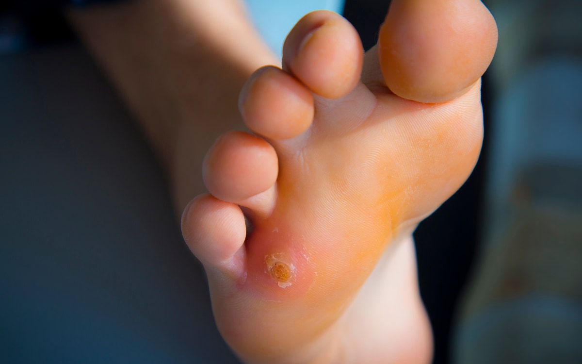 negozi sigarette elettroniche trieste Prodotti e cosmetici per piedi stanchi, calli e duroni main image 1