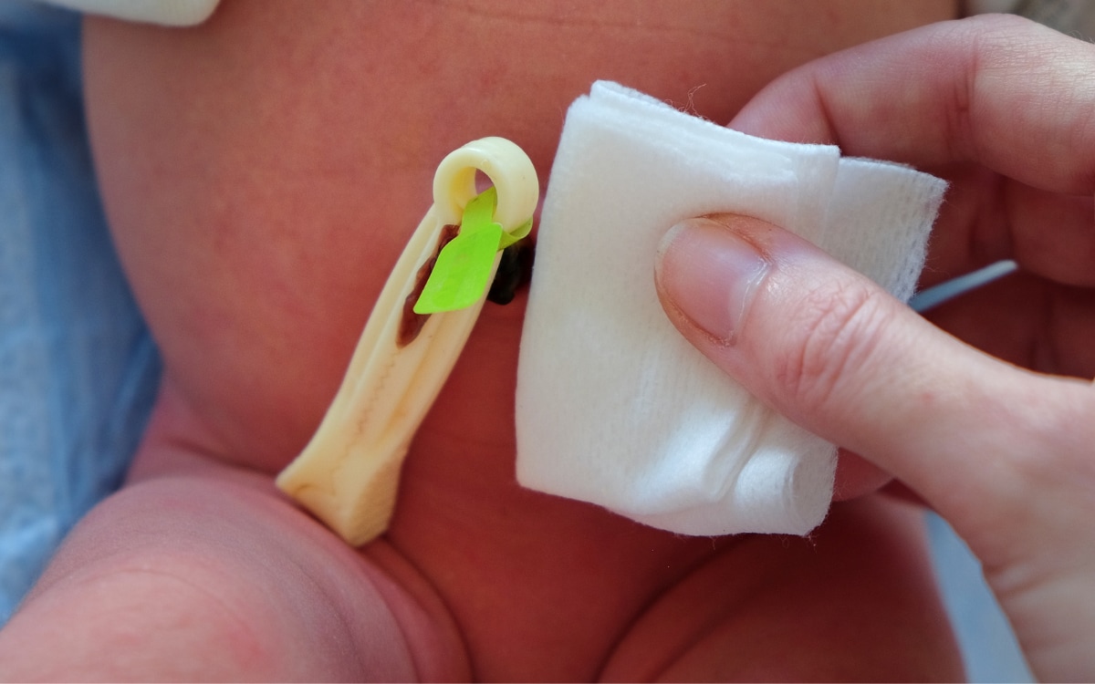 ombelico che butta liquido e puzza Come pulire l'ombelico e cosa può accadere se non si fa main image 0