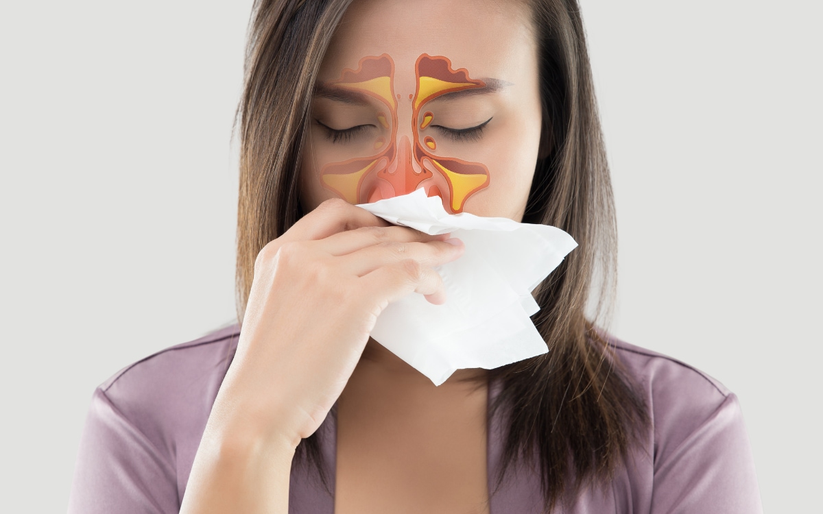 Rinite Allergica: Sintomi, Cause, Prevenzione e Cure