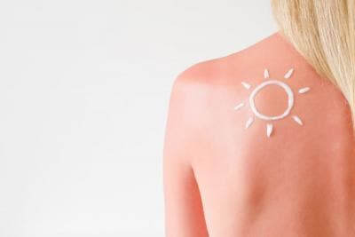 Qual'è il miglior doposole per pelle disidratata e secca 