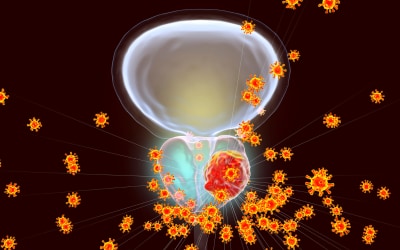 Introduzione a Comprendere la Prostata